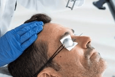 LASER SKIN REJUVENATION
